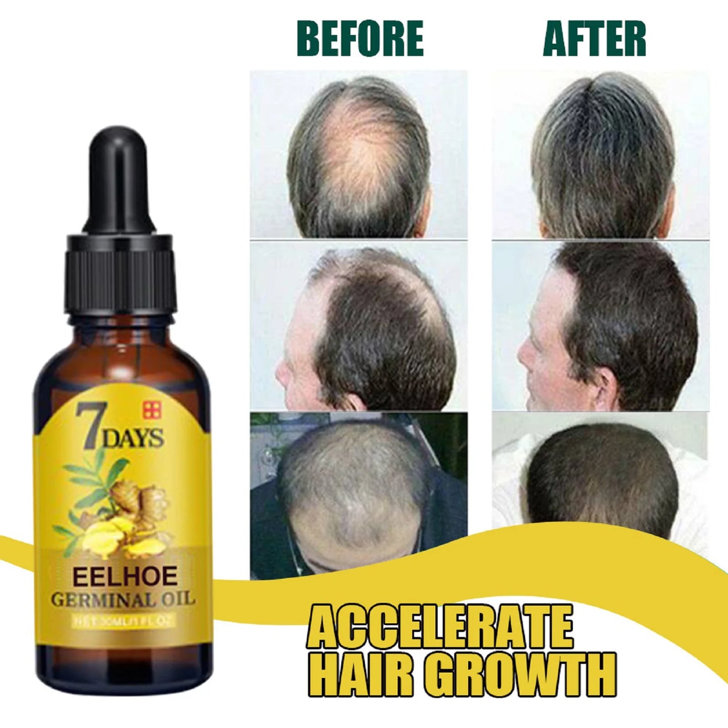 EELHOE Ginger Hair Oil | 20ml | Nourishing Scalp & Hair Care for Women and Men